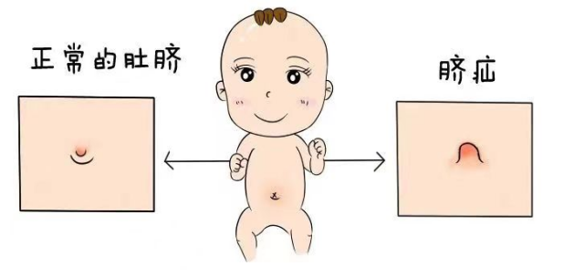 15a66d71f0226c18d6936bd457cf0bcb